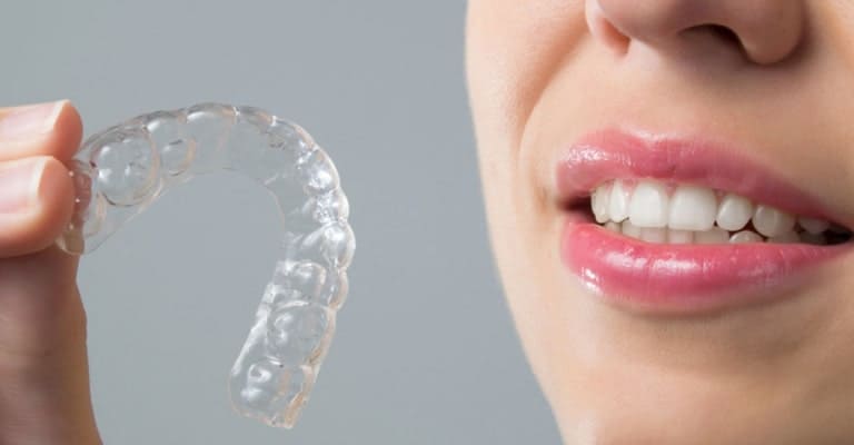 Dental Retainers in Miami & Coral Gables