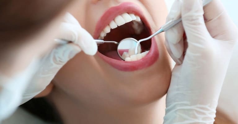 Dental Cleaning - Miami or Coral Gable Dental Office