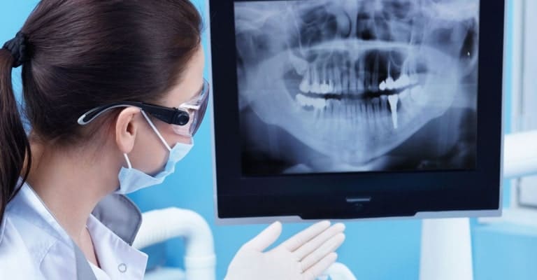 Dental X Rays - Miami or Coral Gable Dental Office